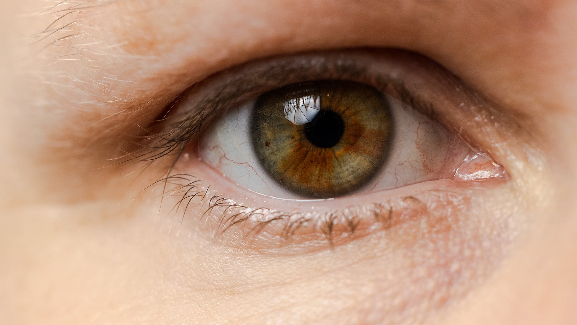 to øyne som illustrerer synsproblemer